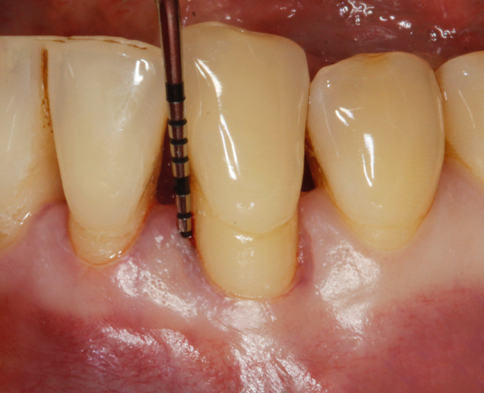 Stomatologia zęby